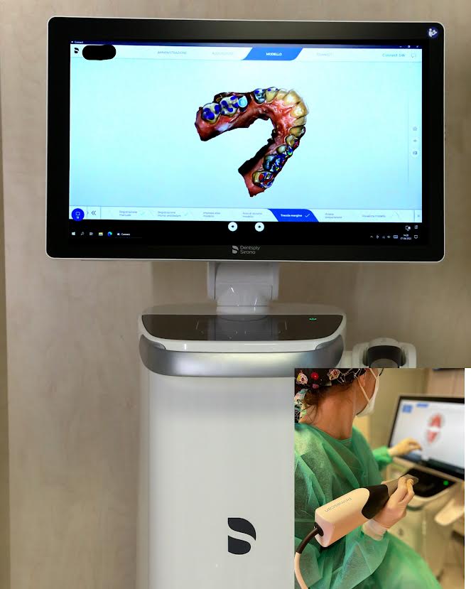Scanner intraorale e operatore
